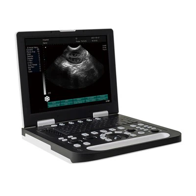 Μηχάνημα υπερήχων φορητού υπολογιστή